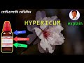 hypericum homeopathic medicine uses benefits symptoms হাইপারিকাম pain killer homeopathy