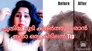 കൊഴിഞ്ഞു പോയ മുടി കിളിർത്തു വരാൻ || ഏതു പ്രായക്കാർക്കും ഉപയോഗിക്കാം || Maalus world|| @MaalusWorld