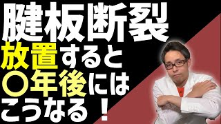 【腱板断裂】リハビリだけで手術しないと腱板断裂はこうなります！