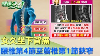 女久坐下背痛 腰椎第4節至薦椎第1節嚴重狹窄 健康2.0