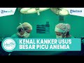 Mengenal Gejala Kanker Usus Besar yang Bisa Picu Anemia, Begini Penyebab dan Cara Atasinya