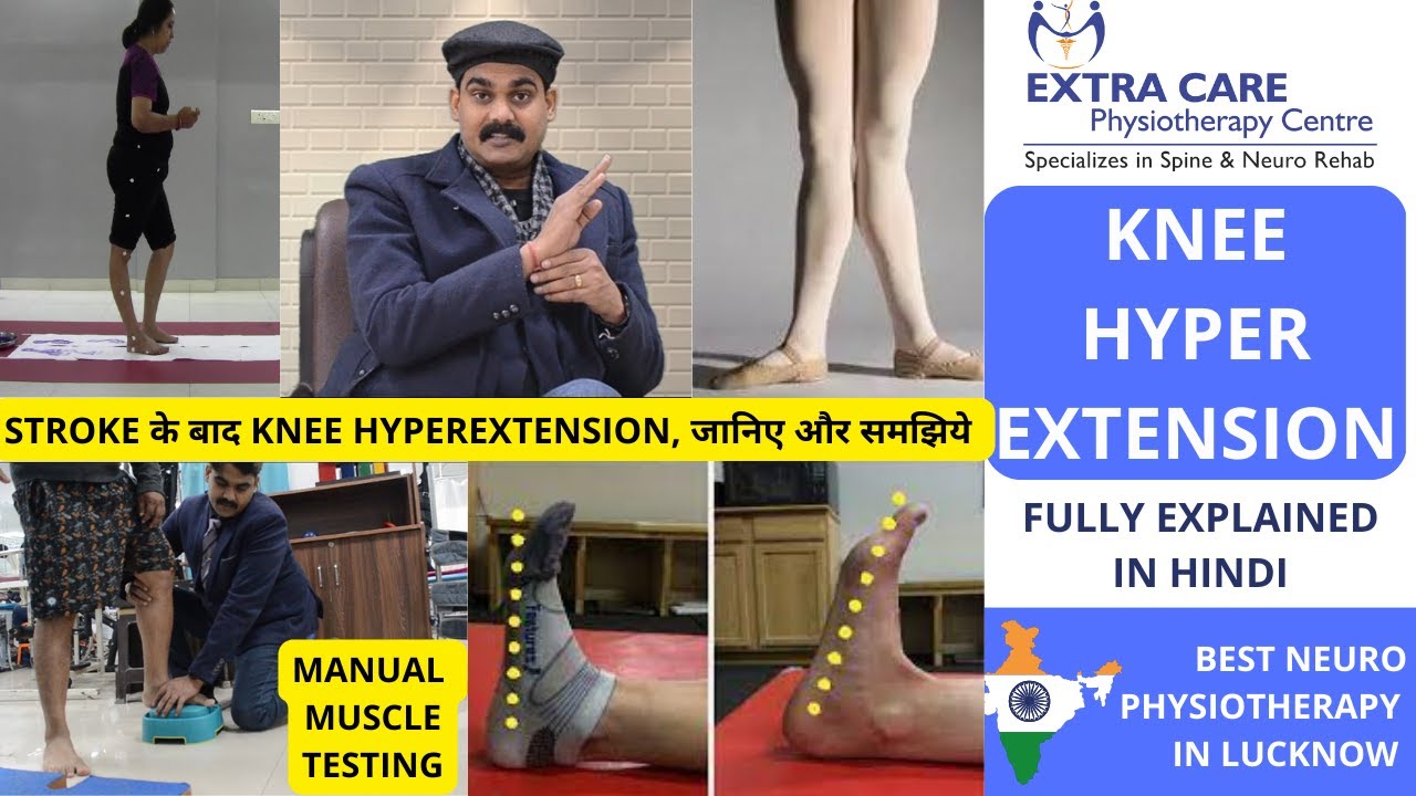 Knee Hyperextension After STROKE | Hyperextended Knee CAUSES & GRADING ...