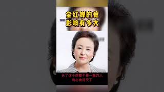 全红婵美人痣#长了这个痣都不是一般的人