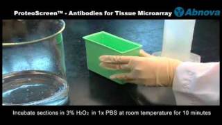 Tissue Microarray