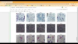 Improved Bald Eagle Search Optimization With Deep Learning Based Cervical Cancer Detection and Class