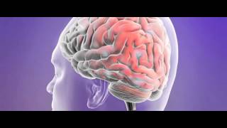 What is a seizure?