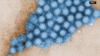 Norovirus outbreak numbers have tripled in Colorado