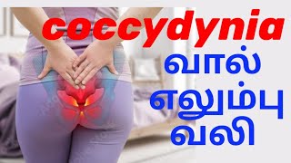 உட்காரும் போது வால் எலும்பு வலி.Tailbone pain.coccydynia .