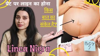 Pregnancy में पेट पर Dark Line|| किस बात का संकेत है?Linea Nigra During Pregnancy🤰