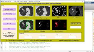 Matlab code for Lung Cancer Detection and Classification using Image Processing