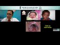 dci webinar 24 clinico pathological perspectives of developmental anomalies of teeth