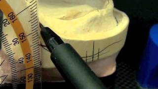 Merz Dental Model analysis