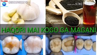 HAQORI MAI KOGO KAWAI GA MAGANIN.