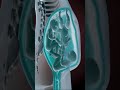 PRECIOUS MOMENTS OF TRIPLETS INSIDE THE WOMB  (3D ANIMATION)