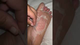Foot Peel Mask | Foot Care Treatment | Foot Mask Results | Baby Soft Feet | Plantifique | shorts