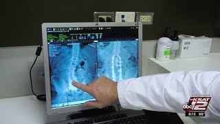 Robotic spine surgery: Faster, safer, better