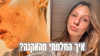 מאקנה חמור לעור מושלם