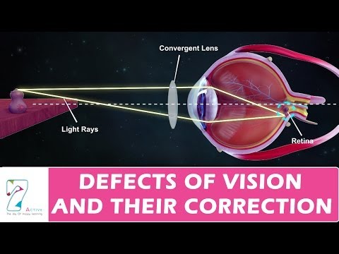 DEFECTS OF VISION AND THEIR CORRECTION DEFECTS OF VISION AND THEIR CORRECTION