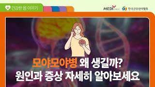 갑작스런 다리 마비 증세로 응급실에 실려간 A씨 - 모야모야병 편