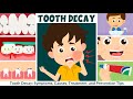 Tooth Decay: Symptoms, Causes, Treatment, and Prevention | Video for Kids | Learning Junction