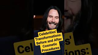 Celebrities' Transformations: Before and After Cosmetic Procedures#shorts #short #movie #tiktok #fy