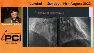 DR.DAMODHAR REDDY- IVUS GUIDED ENTRY IN OSTIAL LAD CTO