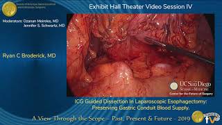 ICG Guided Dissection In Laparoscopic Esophagectomy: Preserving Gastric Conduit Blood Supply