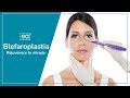 Rejuvenece tu mirada con la blefaroplastia