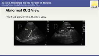 EAST Master Class Webinar - Ultrasound in Trauma and ICU Care