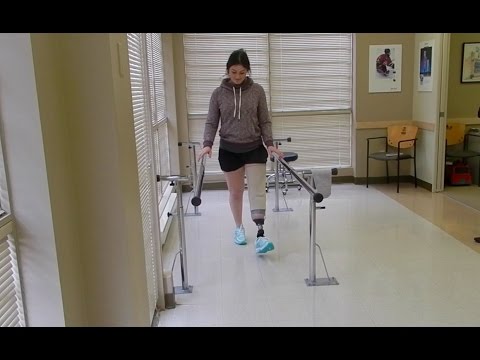 First Time Walking with Prosthetic Leg!