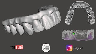 MESHMIXER DENTAL : Come creare una Toronto monolitica forata da un WaxUp  Monolithic t-base Implant