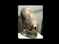 Dr. Edward Spencer - Are we attacked by a different Species? COMPLETE Homo capensis, Paracas skulls