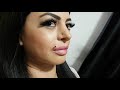 Üst dudak monroe piercing delimi İyileşme süresi