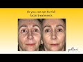 pelleve wrinkle reduction secret medspa el paso