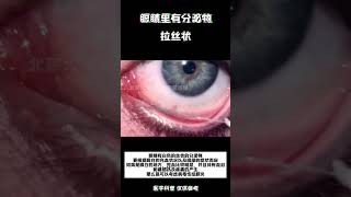 北京大学人民医院曲进锋 医学科普