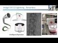 review of percutaneous thrombectomy devices for iliofemoral dvt grand rounds 2.10.2023