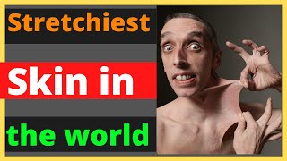 Stretchiest Skin in the world | Guinness world records 🤔 #Shorts