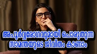 അപൂർവ്വ രോഗവുമായി പൊരുതുന്ന സാമന്തയുടെ ജീവിതം