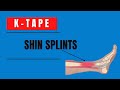 How to treat Shin Splints (Medial tibial stress Syndrome / Periostitis) with Kinesiology tape