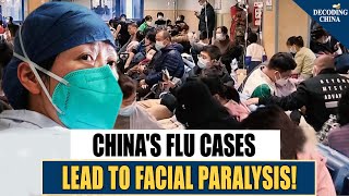 Alarming Outbreak in China: Facial Paralysis in Flu Patients—A Rising Concern