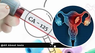 CA125 | CA125 blood test ovarian cancer | All about CA125, Causes of High...#cancer #ovariancancer