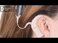 What is a cochlear implant? - Dr. Kumaresh Krishnamoorthy