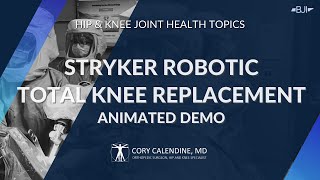Robotic Total Knee Replacement Animated Video