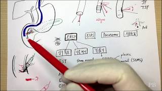 【B2】 췌장 담도분야 술기 1부