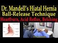 Dr. Mandell's Hiatal Hernia Ball-Release Technique for Hearburn, Acid Reflux (GERD), & Belching