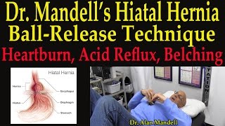 Dr. Mandell's Hiatal Hernia Ball-Release Technique for Hearburn, Acid Reflux (GERD), & Belching