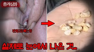 어린 소녀의 눈에서 이상한 것이 나오기 사작합니다.