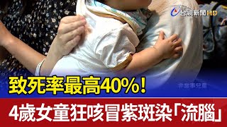 致死率最高40%！ 4歲女童狂咳冒紫斑染「流腦」