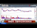 위기의 종목_비덴트 121800