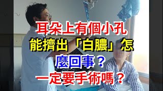 耳朵上有個小孔，能擠出“白膿”怎麼回事？一定要手術嗎？